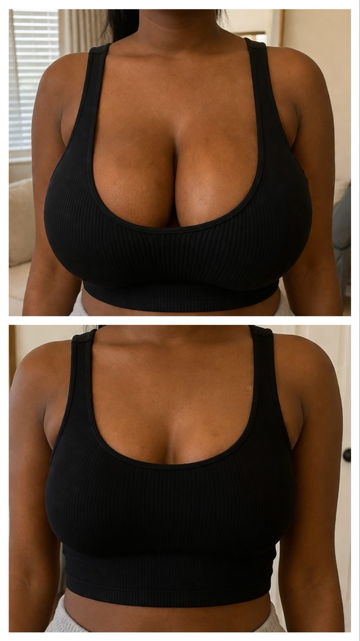 Breast Reduction Cream